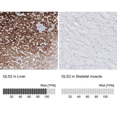 Immunohistochemistry-Paraffin: GLS2 Antibody (CL7716) [NBP2-88907] - Analysis in human liver and skeletal muscle tissues using NBP2-88907 antibody. Corresponding GLS2 RNA-seq data are presented for the same tissues.