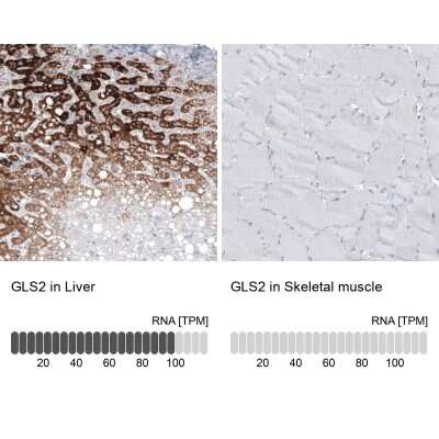 <b>Orthogonal Strategies Validation. </b>Immunohistochemistry-Paraffin: GLS2 Antibody (CL7721) [NBP2-88908] - Analysis in human liver and skeletal muscle tissues using NBP2-88908 antibody. Corresponding GLS2 RNA-seq data are presented for the same tissues.