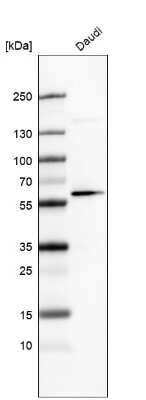 Western Blot: GLS2 Antibody (CL7721) [NBP2-88908] - Analysis in human cell line Daudi.