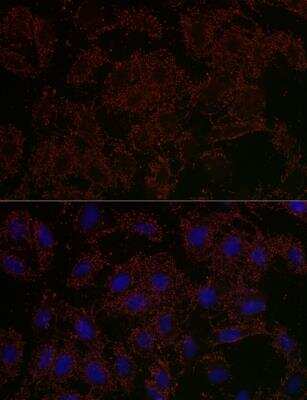 Immunocytochemistry/Immunofluorescence: GLS2 Antibody [NBP3-04094] - Analysis of U2OS cells using GLS2 Rabbit pAb at dilution of 1:200 (40x lens). Blue: DAPI for nuclear staining.