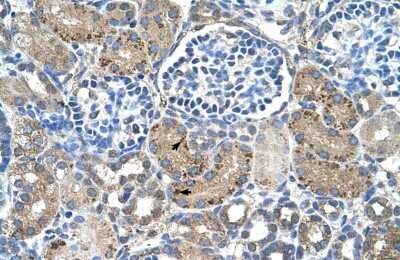 Immunohistochemistry: GLS2 Antibody [NBP1-54773] - Human kidney