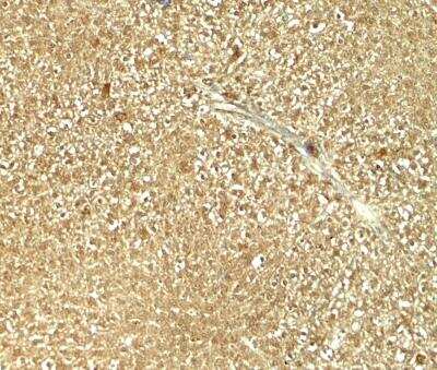 Immunohistochemistry: GLS2 Antibody [NBP2-82071] - Immunohistochemistry of GLS2 in rat liver tissue with GLS2 antibody at 5 ug/mL. 