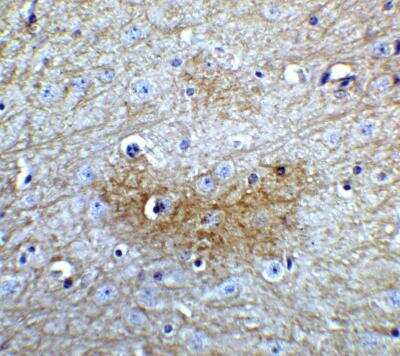 Immunohistochemistry: GLS2 Antibody [NBP2-82071] - Immunohistochemistry of GLS2 in mouse brain tissue with GLS2 Antibody at 5 ug/mL.