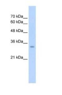 Western Blot: GLS2 Antibody [NBP1-54773] - Titration: 2.5 ug/ml Positive Control: HepG2 cell lysate.