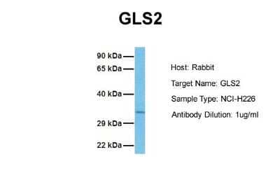 Western Blot: GLS2 Antibody [NBP1-54773] - Sample Tissue: Human NCI-H226 Antibody Dilution: 1.0 ug/ml