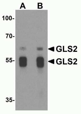 Western Blot: GLS2 Antibody [NBP2-82071] - Western blot analysis of GLS2 in rat liver tissue lysate with GLS2 antibody at (A) 1 and (B) 2 ug/mL