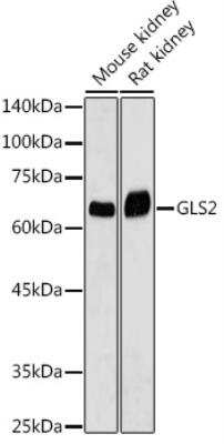 Western Blot: GLS2 Antibody [NBP3-04094] - Analysis of extracts of various cell lines, using GLS2 antibody at 1:1000 dilution.Secondary antibody: HRP Goat Anti-Rabbit IgG (H+L)  at 1:10000 dilution.Lysates/proteins: 25ug per lane. Blocking buffer: 3% nonfat dry milk in TBST.Detection: ECL Basic Kit. Exposure time: 1s.