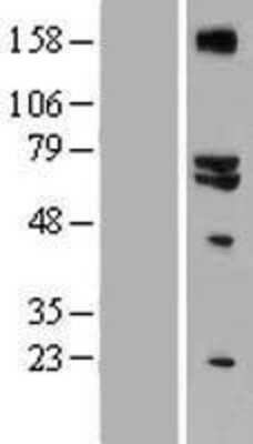 Western Blot: GLS2 Overexpression Lysate (Adult Normal) [NBP2-07429] Left-Empty vector transfected control cell lysate (HEK293 cell lysate); Right -Over-expression Lysate for GLS2.