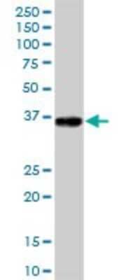 Western Blot: GLT1D1 Antibody [H00144423-B01P] - Analysis of GLT1D1 expression in human placenta.