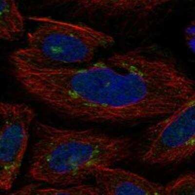 Immunocytochemistry/Immunofluorescence: GLT8D2 Antibody [NBP3-17856] - Staining of human cell line SiHa shows localization to the Golgi apparatus.