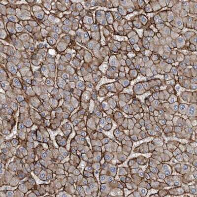 Immunohistochemistry-Paraffin: GLT8D2 Antibody [NBP1-83538] - Staining of human liver shows strong membranous and cytoplasmic positivity in hepatocytes.
