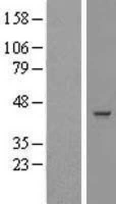 Western Blot: GLT8D2 Overexpression Lysate (Adult Normal) [NBL1-11127] Left-Empty vector transfected control cell lysate (HEK293 cell lysate); Right -Over-expression Lysate for GLT8D2.
