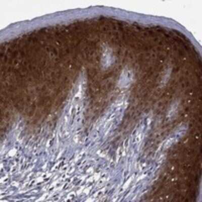 Immunohistochemistry-Paraffin: GLTP Antibody [NBP3-17497] - Staining of human skin shows strong nuclear and cytoplasmic positivity in epidermal cells.