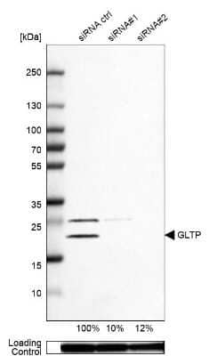 Western Blot: GLTP Antibody [NBP2-31642] - Analysis in U-87MG ATCC cells transfected with control siRNA, target specific siRNA probe #1 and #2,. Remaining relative intensity is presented. Loading control: Anti-GAPDH.