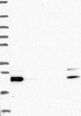 Western Blot: GLTP Antibody [NBP3-17497] - Lane 1: Marker [kDa] 250, 130, 95, 72, 55, 36, 28, 17, 10;   Lane 2: RT4;   Lane 3: U-251 MG;   Lane 4: Human Plasma;   Lane 5: Liver;   Lane 6: Tonsil