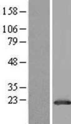 Western Blot: GLTP Overexpression Lysate (Adult Normal) [NBL1-11128] Left-Empty vector transfected control cell lysate (HEK293 cell lysate); Right -Over-expression Lysate for GLTP.