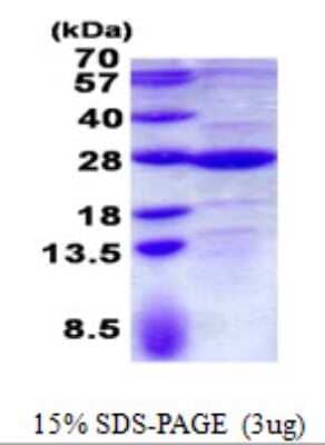 SDS-Page: GLTP Protein [NBP2-23081]