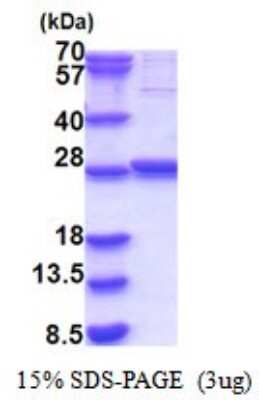 SDS-Page: GLTPD1 Recombinant Protein [NBP2-51842] - 15% SDS Page (3 ug)