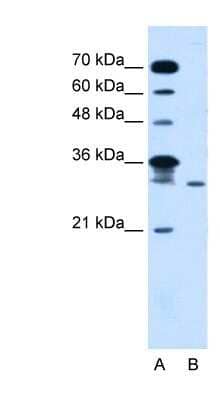 Western Blot: GLTPD2 Antibody [NBP1-80543] - Jurkat cell lysate, concentration 5.0ug/ml.
