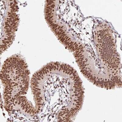 Immunohistochemistry-Paraffin: GLTSCR1 Antibody [NBP2-30603] - Staining of human fallopian tube shows strong nuclear positivity in glandular cells.