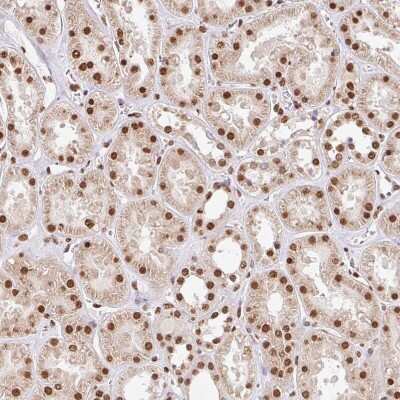 Immunohistochemistry-Paraffin: GLTSCR1 Antibody [NBP2-30603] - Staining of human kidney shows strong nuclear positivity in cells in tubules.