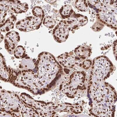 Immunohistochemistry-Paraffin: GLTSCR1 Antibody [NBP2-30603] - Staining of human placenta shows strong nuclear positivity in trophoblastic cells.