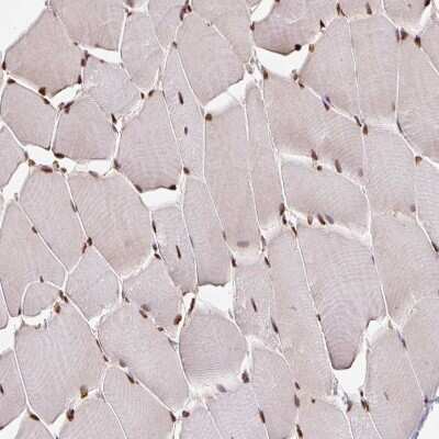 Immunohistochemistry-Paraffin: GLTSCR1 Antibody [NBP2-30603] - Staining of human skeletal muscle shows strong nuclear positivity in myocytes.