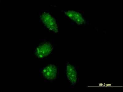 Immunocytochemistry/Immunofluorescence: GLTSCR2 Antibody [H00029997-B01P] - Analysis of purified antibody to GLTSCR2 on HeLa cell. (antibody concentration 10 ug/ml)