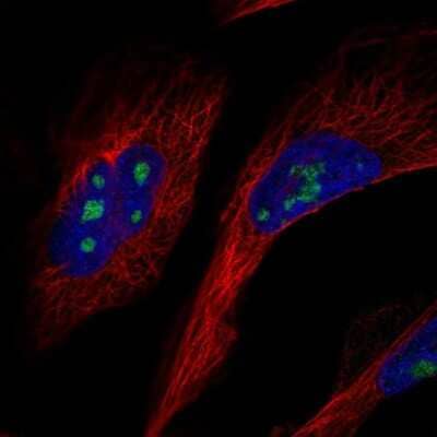 Immunocytochemistry/Immunofluorescence: GLTSCR2 Antibody [NBP2-56742] - Staining of human cell line U-2 OS shows localization to nucleoli.