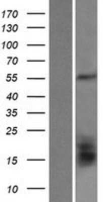 Western Blot: GLUD2 Overexpression Lysate (Adult Normal) [NBP2-07493] Left-Empty vector transfected control cell lysate (HEK293 cell lysate); Right -Over-expression Lysate for GLUD2.