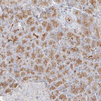 Immunohistochemistry: GLUT12 Antibody [NBP1-91944] - Staining of human pancreas shows moderate cytoplasmic positivity in exocrine glandular cells.