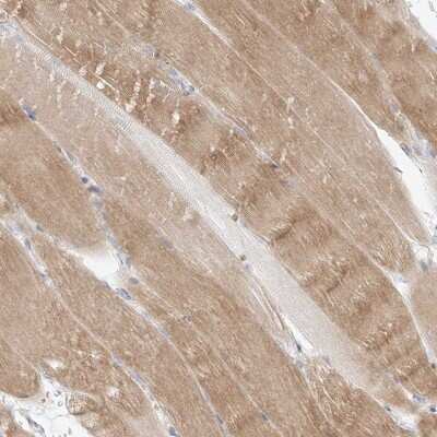 Immunohistochemistry-Paraffin: GLUT12 Antibody [NBP1-91944] - Staining of human skeletal muscle shows moderate cytoplasmic positivity in myocytes.