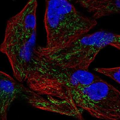 Immunocytochemistry/Immunofluorescence: GLXR5 Antibody [NBP2-57059] - Staining of human cell line RH-30 shows localization to mitochondria.