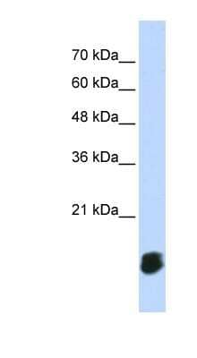 Western Blot: GLXR5 Antibody [NBP1-57645] - Titration: 0.2-1 ug/ml, Positive Control: Transfected 293T.