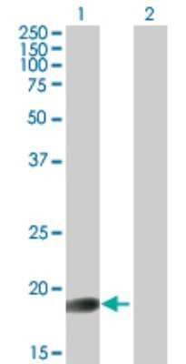 Western Blot: GLYAT Antibody [H00010249-B01P] - Analysis of GLYAT expression in transfected 293T cell line by GLYAT polyclonal antibody.  Lane 1: GLYAT transfected lysate(17.93 KDa). Lane 2: Non-transfected lysate.