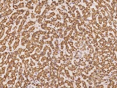 Immunohistochemistry-Paraffin: GLYATL1 Antibody [NBP2-98175] - Immunochemical staining of human GLYATL1 in human kidney with rabbit polyclonal antibody at 1:100 dilution, formalin-fixed paraffin embedded sections.