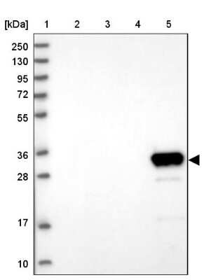 Western Blot GLYATL1 Antibody - BSA Free