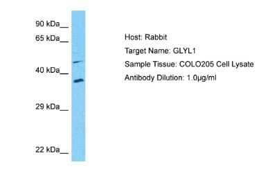 Western Blot: GLYATL1 Antibody [NBP2-84985] - Host: Rabbit. Target Name: GLYL1. Sample Type: COLO205 Whole Cell lysates. Antibody Dilution: 1.0ug/ml