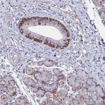 Immunohistochemistry-Paraffin GLYATL2 Antibody - BSA Free