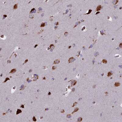 Immunohistochemistry-Paraffin: GLYATL3 Antibody [NBP1-91947] - Staining of human cerebral cortex shows strong cytoplasmic positivity in neuronal cells.