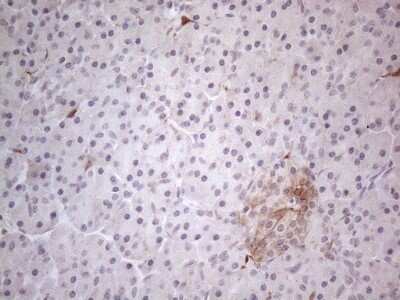 Immunohistochemistry: GM-CSF Antibody (8G5) [NBP2-46364] - Analysis of Human pancreas tissue. (Heat-induced epitope retrieval by 1mM EDTA in 10mM Tris buffer (pH8.5) at 120C for 3 min)