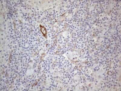 Immunohistochemistry: GM-CSF Antibody (8G5) [NBP2-46364] - Analysis of Human lymph node tissue. (Heat-induced epitope retrieval by 1mM EDTA in 10mM Tris buffer (pH8.5) at 120C for 3 min)