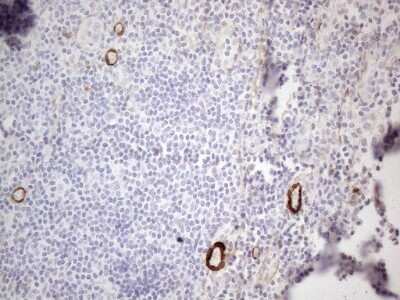 Immunohistochemistry: GM-CSF Antibody (8G5) [NBP2-46364] - Analysis of Human tonsil tissue. (Heat-induced epitope retrieval by 1mM EDTA in 10mM Tris buffer (pH8.5) at 120C for 3 min)