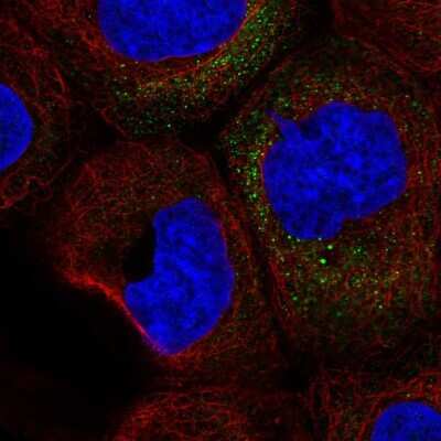 Immunocytochemistry/Immunofluorescence: GM-CSF Antibody [NBP2-56177] - Staining of human cell line A-431 shows localization to vesicles. Antibody staining is shown in green. 