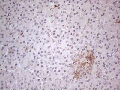 Immunohistochemistry: GM-CSF Antibody (OTI8G5) - Azide and BSA Free [NBP2-70462] - Analysis of Human pancreas tissue. (Heat-induced epitope retrieval by 1mM EDTA in 10mM Tris buffer (pH8.5) at 120C for 3 min)