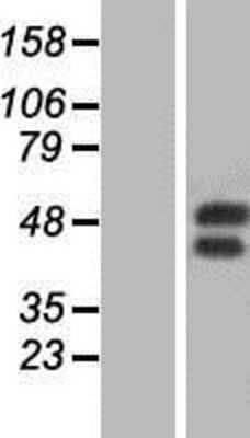 Western Blot: GM-CSF Receptor alpha Overexpression Lysate (Adult Normal) [NBP2-10431] Left-Empty vector transfected control cell lysate (HEK293 cell lysate); Right -Over-expression Lysate for GM-CSF Receptor alpha.