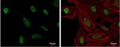 Immunocytochemistry/Immunofluorescence: GM632 Antibody [NBP2-16692] -  HeLa cells were fixed in 4% paraformaldehyde at RT for 15 min. Green: ZNF512B protein stained by ZNF512B antibody [N2C1], Internal diluted at 1:500. Red: phalloidin, a cytoskeleton marker, diluted at 1:200. Blue: Hoechst 33342 staining. Scale bar = 10 um.