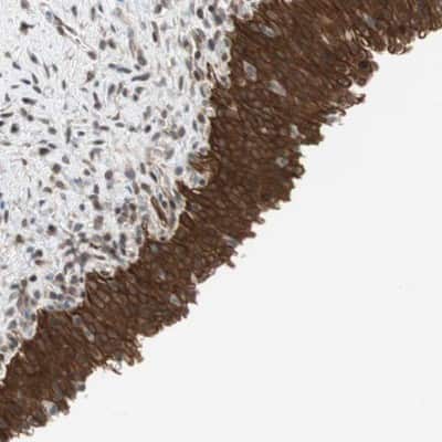 Immunohistochemistry-Paraffin: GM632 Antibody [NBP1-91948] - Staining of human urinary bladder shows strong cytoplasmic positivity in urothelial cells.