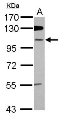 Western Blot: GM632 Antibody [NBP2-16692] - Sample (30 ug of whole cell lysate) A: IMR32 7. 5% SDS PAGE gel, diluted at 1:1000.