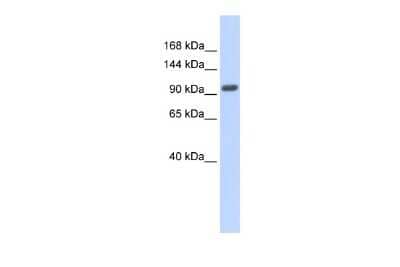 Western Blot: GM632 Antibody [NBP2-84990] - WB Suggested Anti-ZNF512B Antibody Titration: 0.2-1 ug/ml. ELISA Titer: 1:62500. Positive Control: Human Placenta